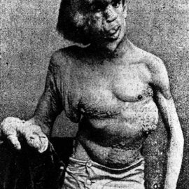 elephantman
