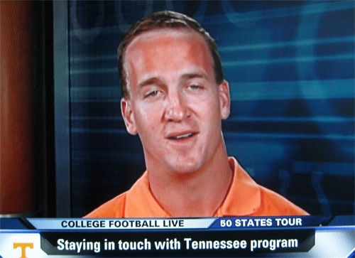 manning forehead