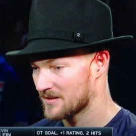 Kevin-Klein-ear-bleeding
