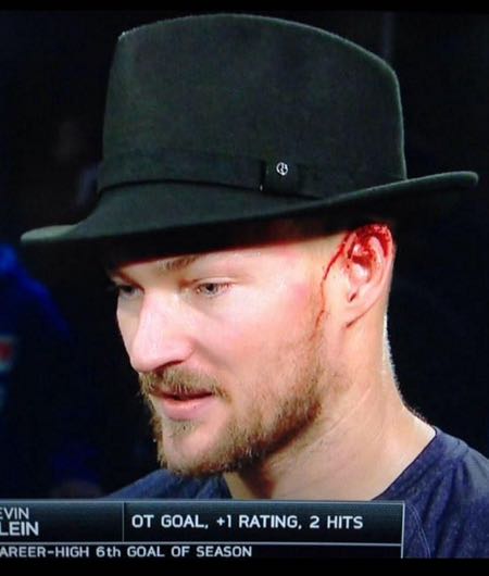 Kevin-Klein-ear-bleeding