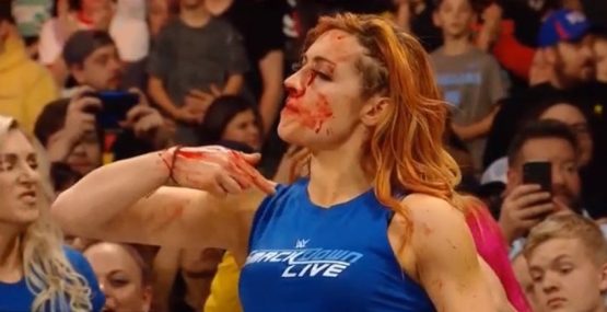 becky lynch